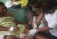 PN aclara incidente donde salió herido Romer Ayala