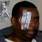 Dominicano se niega a comprar celulares robados y pierde un ojo