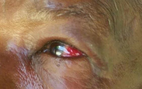 Ignominia: Qué pasó con el pelafustán que le propinó golpiza a señora de 75 años
