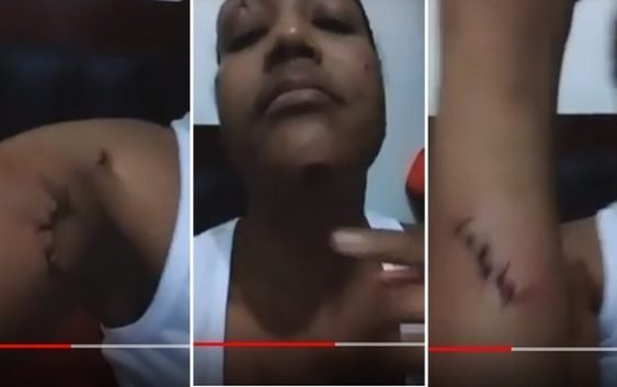 Teme por su vida: Clama porque apresen delincuente intentó asesinarla; Vídeo