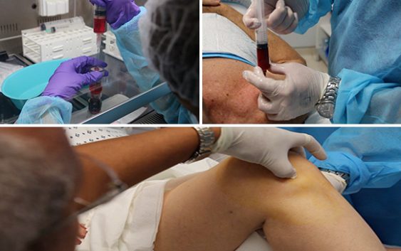 3Med Health Institute y UNEV auspician tratamientos de Plasma Rico en Plaquetas
