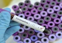 Coronavirus (Covid-19): Pacientes con enfermedades crónicas: ¿Por qué la adherencia al tratamiento y vacunación es crucial?