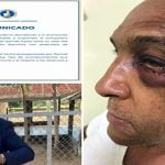PRM suspende con propuesta de expulsión a Darinel Valdez por agredir exalcalde Alberto Polanco, de Laguna Salada