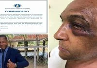 PRM suspende con propuesta de expulsión a Darinel Valdez por agredir exalcalde Alberto Polanco, de Laguna Salada