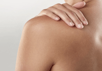 Proteger la piel de radiación UV una de las acciones más importantes para reducir riesgo de cáncer de piel