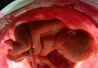 Aborto: Con 6 meses alegó no tenía para comer; Niña nació viva y la médico la asfixió en una funda
