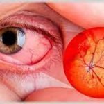 Atención integral a pacientes diabéticos puede ayudar a prevenir enfermedades de la vista