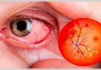 Atención integral a pacientes diabéticos puede ayudar a prevenir enfermedades de la vista