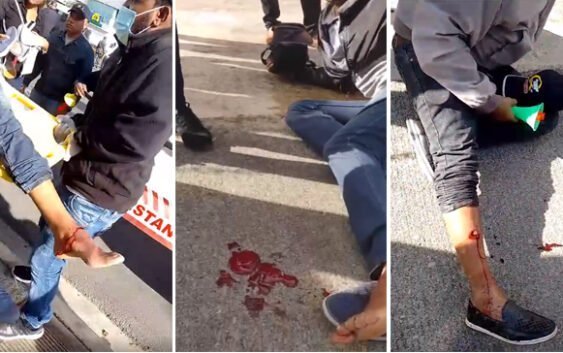 Abinader y «su reformada Policía» agreden a tiros expolicías que reclaman mejoría salarial; Varios heridos; Vídeos